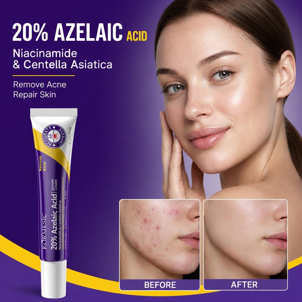 20% Azelaic Acid essence Deep  - Azelaic Acid Cream review and price