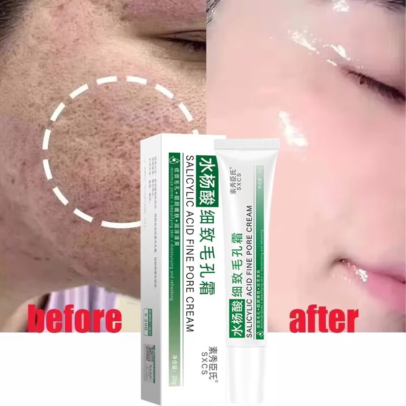 Salicylic Acid Pore Shrinking  - Azelaic Acid Cream review and price